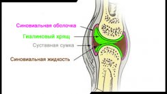 Работают ли хондропротекторы?