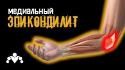Что Делать Если Болит Локоть При Подтягиваниях? (Медиальный Эпикондилит)